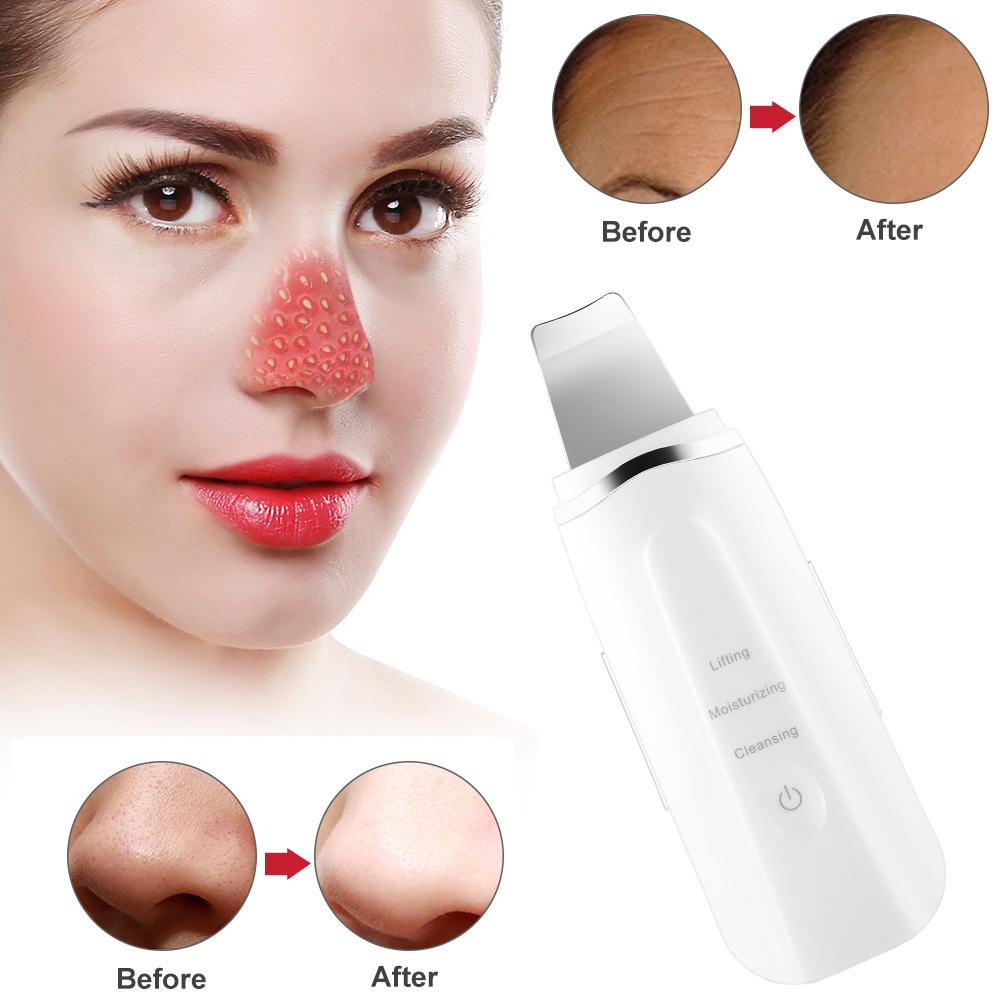 BeautyFaceScrubber™ Ultrasonic Face Cleaning Skin Scrubber