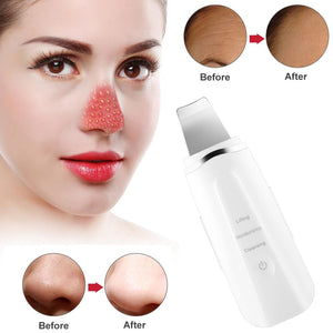 BeautyFaceScrubber™ Ultrasonic Face Cleaning Skin Scrubber